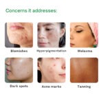 nyxia skin lightening cream
