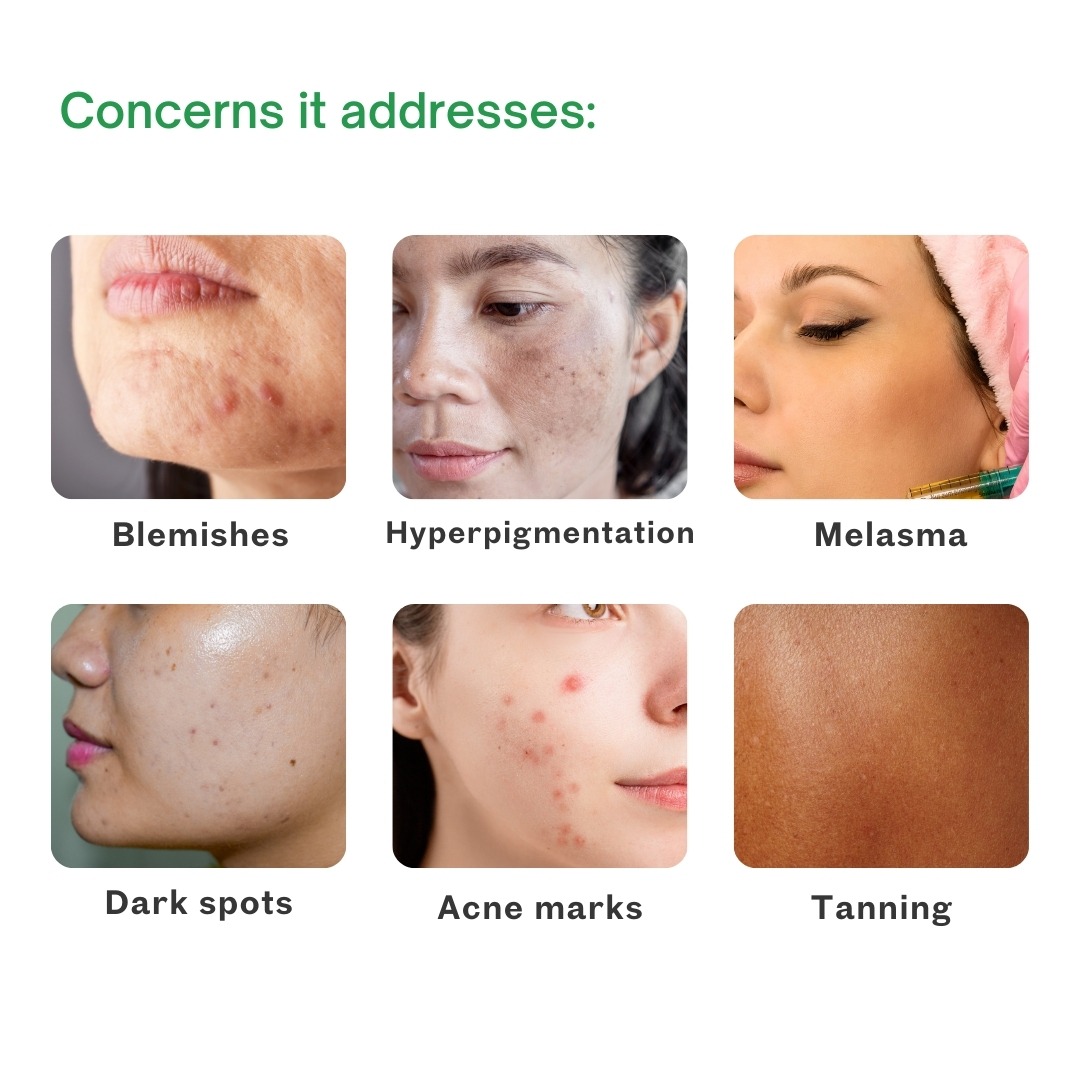 nyxia skin lightening cream nyxia skin lightening cream